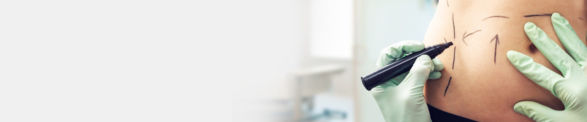 3D lipo - Newark, Nottingham, Chesterfield - Medskin Clinic
