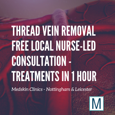 Thread Vein Removal Derby Nottingham Leicester