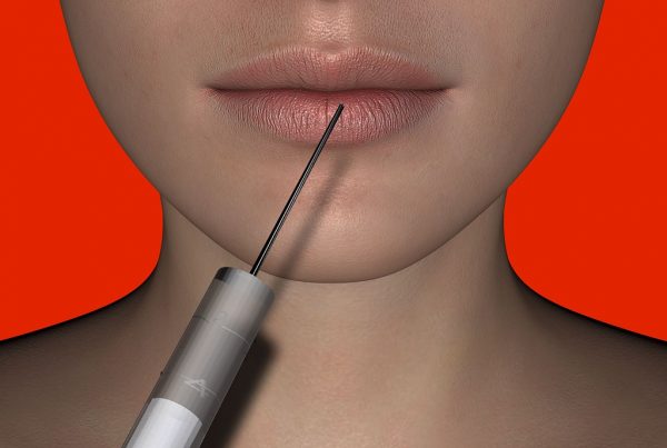 Busting the Myths About Botox -