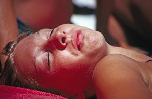 The benefits of having your sun spots removed - MedSkin Clinic