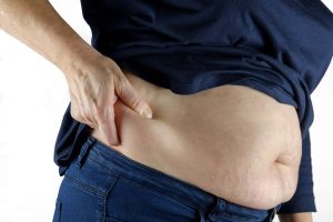 Three non-aesthetic reasons to remove fat with 3D lipo -
