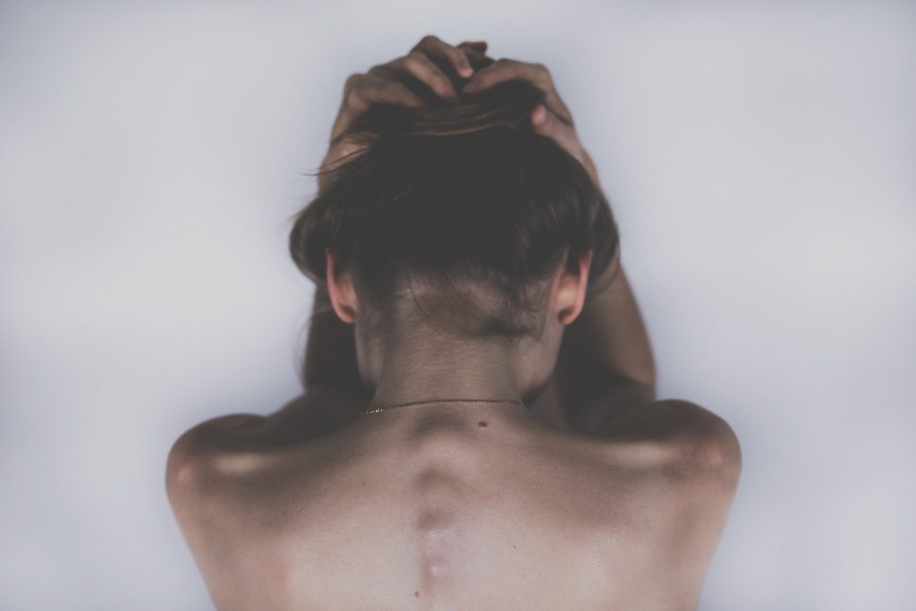 Why Is Your Back So Prone to Acne? -