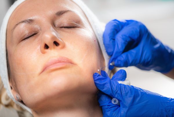 Aesthetic Medicine Facial Contouring with 3D Meso Threads Lip Mouth Wrinkles Injections Fillers Medical Treatment Nottingham Beeston West Bridgford