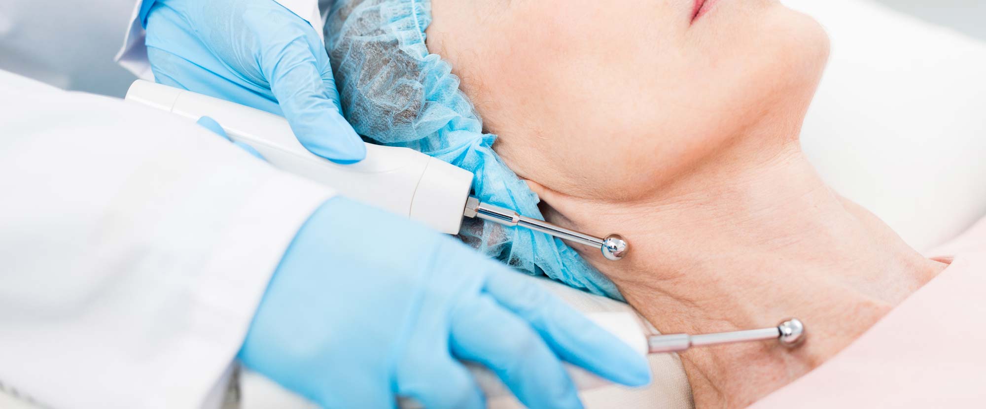 wrinkly turtle neck treatment skin professional nottingham beeston west bridgford chesterfield