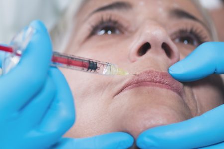 Everything you need to know about lip fillers - MedSkin Clinic