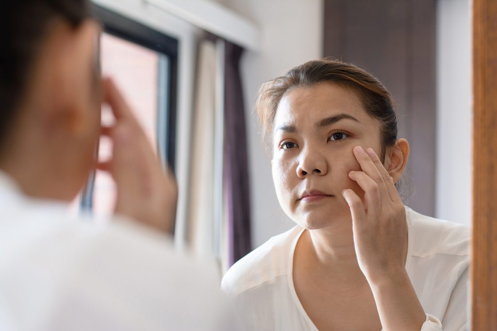 Crow's feet : Causes and solutions - middle aged asian woman looking at wrinkles in mir CGPLMZJ Botox Nottingham Dermal Fillers Beeston West_Bridgford Skin Tag Removal Wart Cheek Fillers Chesterfield Lincoln Leicester Beauty Skin Dermatology Treatments