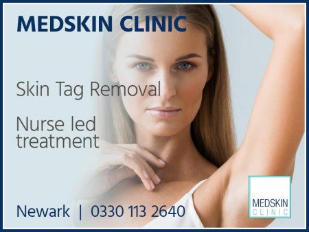 Same-Day Skin Tag Removal in Newark: Fast Relief Options - Newark Skin Tag Removal Square Banners Same-Day Skin Tag Removal in Newark