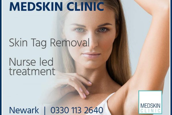 Newark-Skin-Tag-Removal-Square-Banners