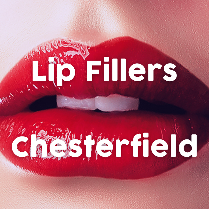 Lip Fillers Chesterfield – Time for The Perfect Pout
