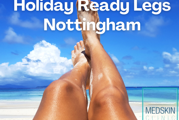 Best Treatments for Holiday Ready Legs Nottingham
