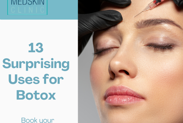 13 Surprising Uses For Botox - Botox Treatment Nottingham, Lincoln, Newark and Chesterfield, Nurse Led Clinics