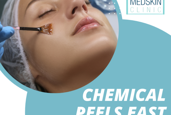 Chemical Peels East Midlands