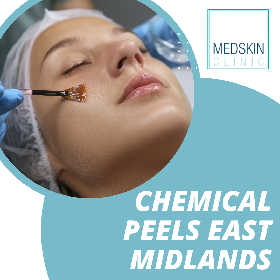 Chemical Peels East Midlands – Getting Your Skin Party Season Ready